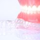 What does Invisalign cost?