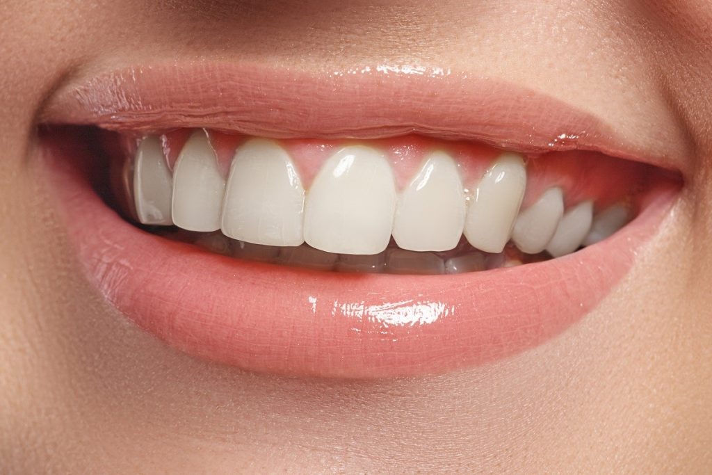 Aligners vs. Braces: Which Is Right for You?